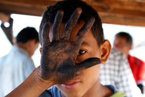 Criança cobrindo rosto com a palma da mão suja